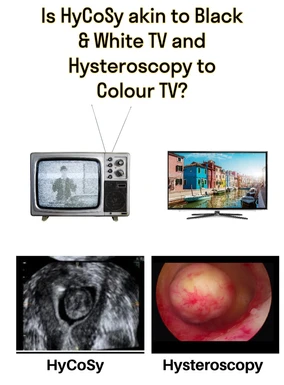HyCoSy Vs Hysteroscopy ( Is HyCoSy akin to black and white TV and Hysteroscopy to Colour TV?)