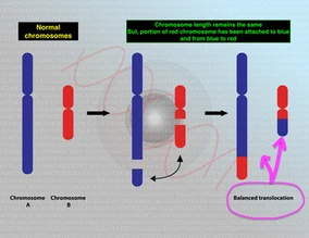 Balanced translocation and risk of recurrent miscarriage